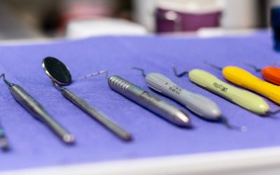 Parodontoza în 2025: cum schimbă laserul regulile jocului