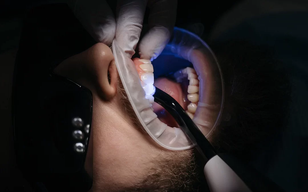 Top 5 metode eficiente pentru tratarea cariilor dentare în 2025