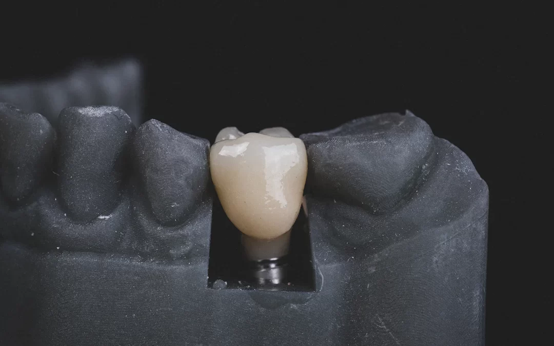 Secretele unei recuperări rapide după implant dentar în 2025