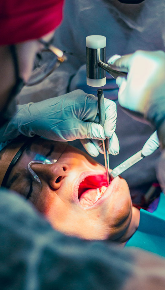 operatie Implant dentar exq clinic Cluj