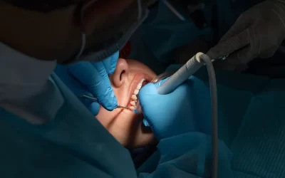 Betadine vs alte antiseptice: Ce funcționează mai bine în chirurgie orală?