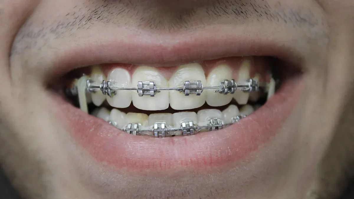 igiena orală cu aparat dentar
