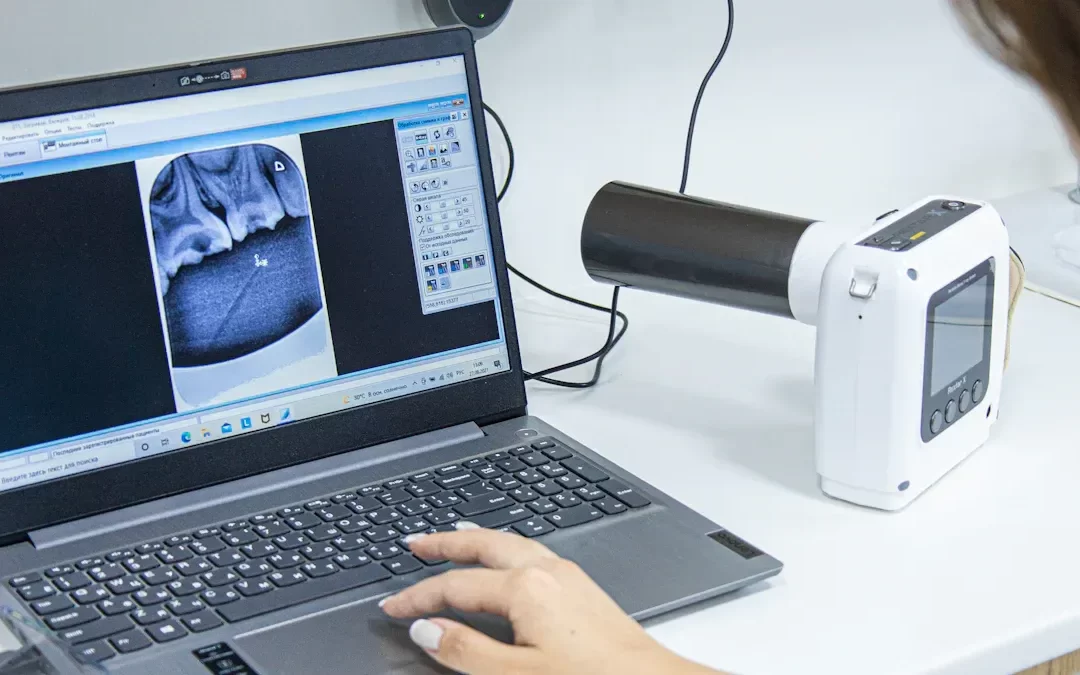 Beneficiile și riscurile radiografiei dentare pe înțelesul tuturor
