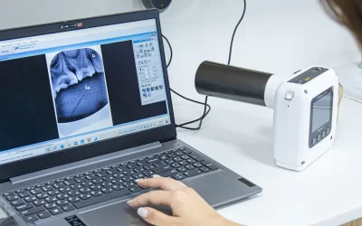 Beneficiile și riscurile radiografiei dentare pe înțelesul tuturor