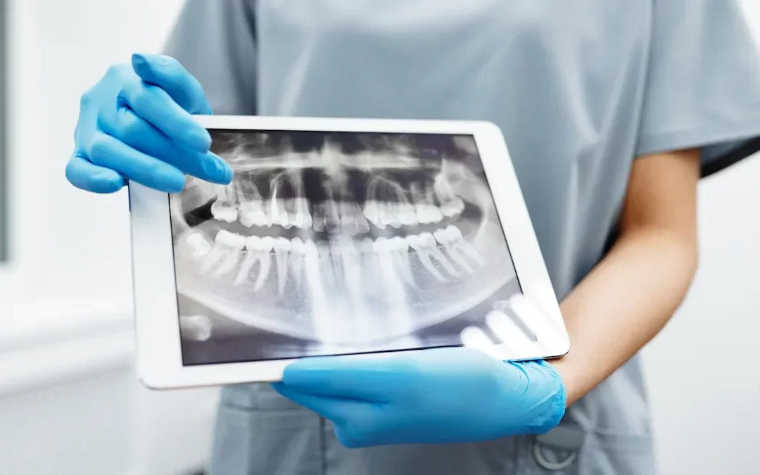 Pregătirea pentru radiografia dentară: greșeli de evitat