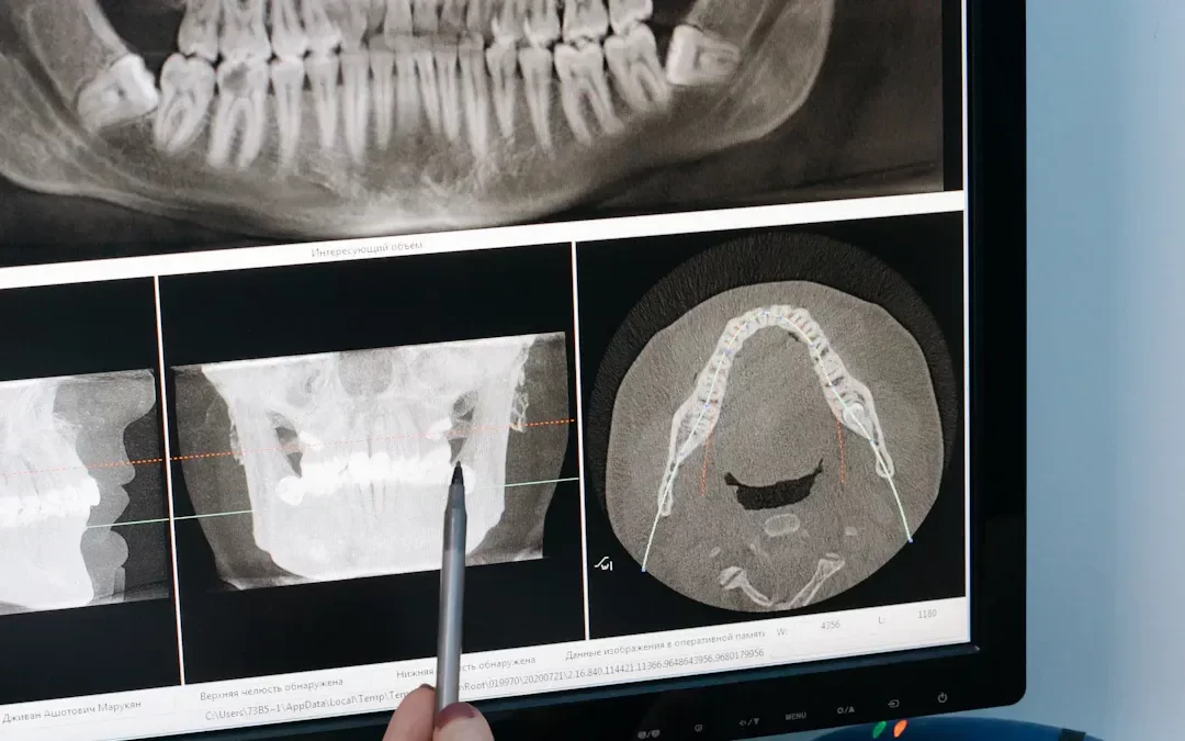Radiografii dentare în Cluj-Napoca: Ce opțiuni ai și când sunt recomandate