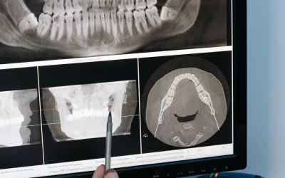 Radiografii dentare în Cluj-Napoca: Ce opțiuni ai și când sunt recomandate