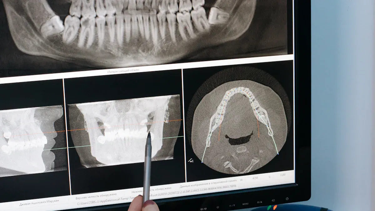 Radiografii dentare în Cluj-Napoca: Ce opțiuni ai și când sunt recomandate