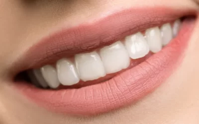 Ghid complet al procedurilor de estetică dentară pentru un zâmbet sănătos