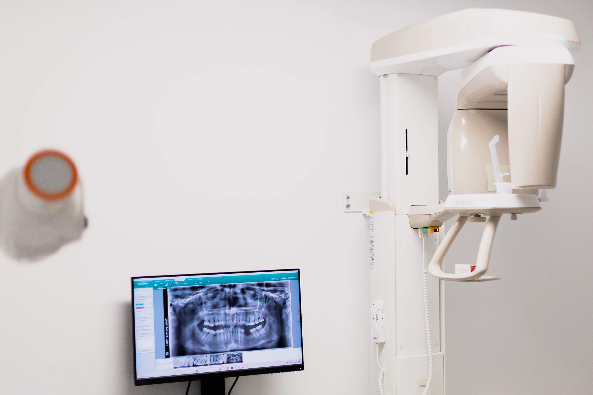 radiologie dentara manastur Cluj Napoca4 Radiologie Dentară Cluj – Mănăștur: Tehnologie digitală, rezultate rapide10